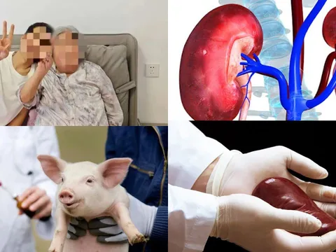 Ca ghép thận lợn đầu tiên ở châu Á sống hơn 200 ngày