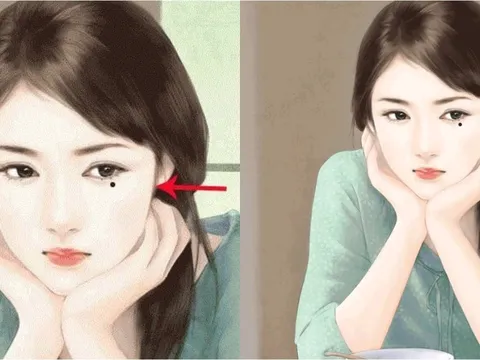 3 nốt ruồi may mắn: Ai có được cả đời sống trong nhung lụa, thật đáng chúc mừng