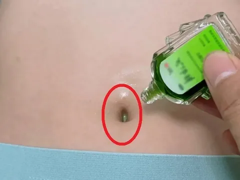 Bôi 1 giọt dầu gió vào rốn trước khi ngủ, tránh cả đống bệnh