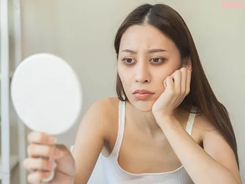 Chuyên gia bật mí tuyệt chiêu đỡ thâm và bọng mắt nhanh chóng