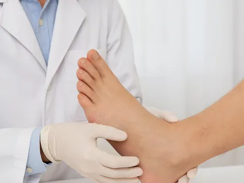 5 dấu hiệu ở bàn chân cảnh báo ung thư sớm: Nhìn tưởng nhỏ nhưng có thể cứu mạng bạn