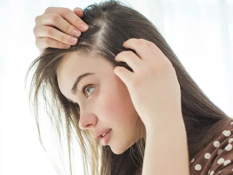 2 loại đồ uống là “thủ phạm thầm lặng” khiến tóc yếu và nhanh bạc