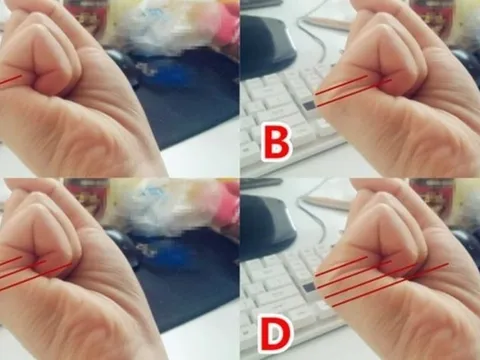 Nắm tay lại mà đếm đường chỉ tay: Ra đúng số này đời ăn không hết của