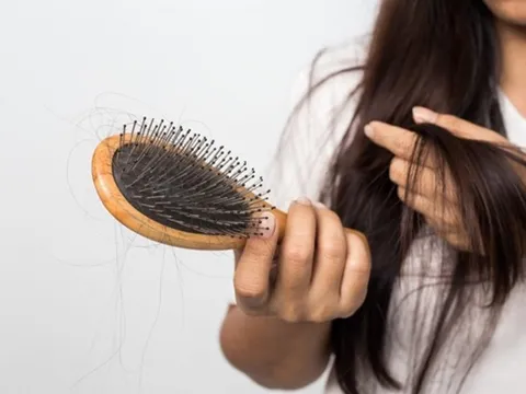 Mách nàng mẹo chăm sóc da đầu đúng cách trong mùa thu để ngăn ngừa rụng tóc