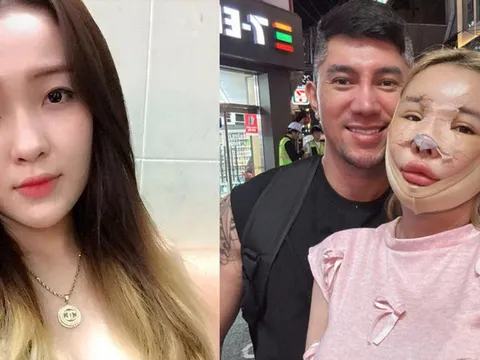 Ngỡ ngàng dung mạo của Ngân 98 trước khi trải qua 12 cuộc phẫu thuật thẩm mỹ