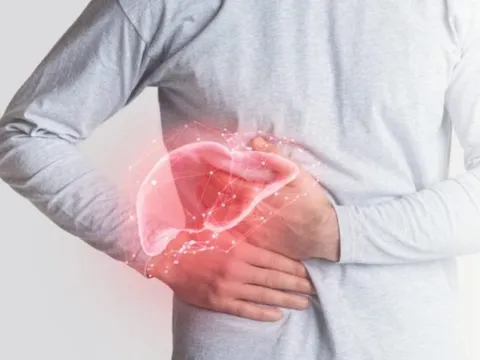 Ung thư gan: Không phải do chán ăn, đây mới là những dấu hiệu sớm cảnh báo bệnh nguy hiểm