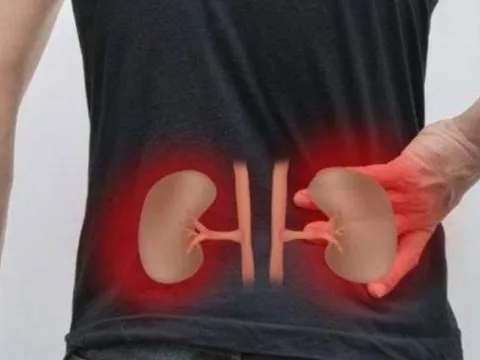 Dù có tiêu hết tiền cũng không cứu nổi: 4 căn bệnh “vô phương”, càng cố chữa càng mất sức khỏe