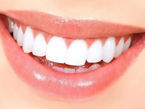 Mẹo “tự chế” giúp răng trắng sáng tự nhiên