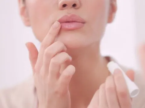Mách nàng 5 cách dưỡng môi mịn màng, đẩy lùi da chết