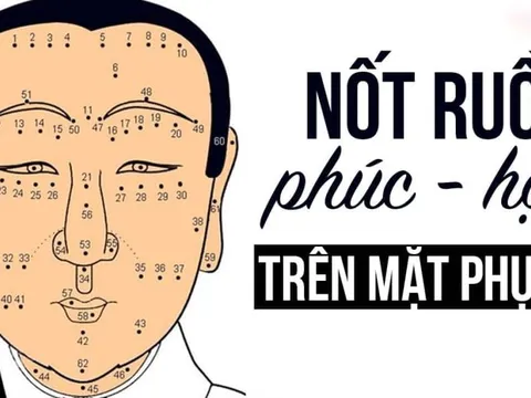 4 nốt ruồi chặn cửa tài lộc: Nên xóa bỏ