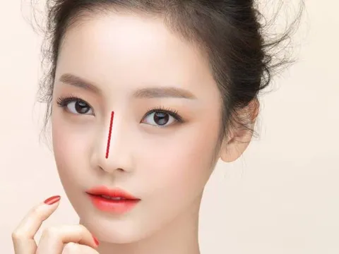 Xem Tướng mũi của chị em để dự đoán chồng tương lai