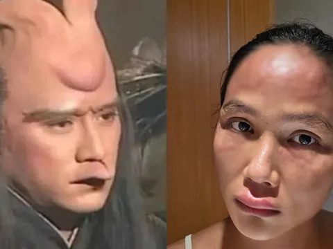 Mẹ bỉm H’Hen Niê gặp "bệnh lạ" sau sinh dù ở cữ sang chảnh nửa tỷ/tháng