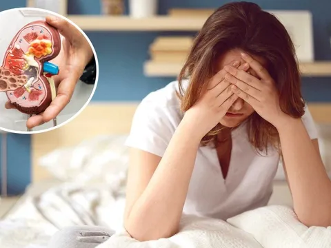 Cảnh báo 4 dấu hiệu sớm của suy thận, nhiều người tưởng bệnh vặt