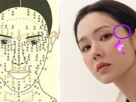 4 vị trí nốt ruồi “vàng” báo hiệu cuộc đời giàu sang