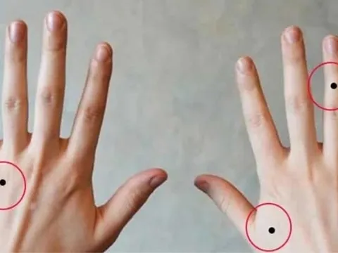 Chỉ cần có nốt ruồi này: Cả đời hưởng phú quý, may mắn không ngừng