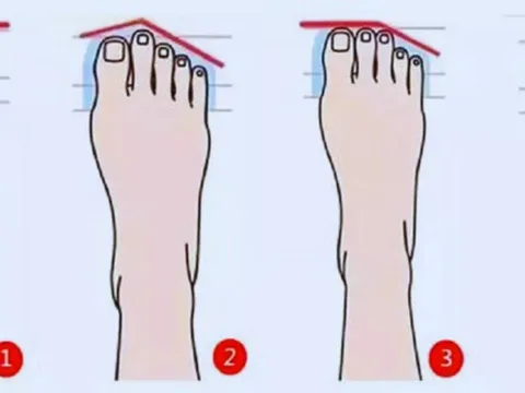 Xem hình dáng bàn chân, biết rõ tính cách tiềm ẩn của bạn