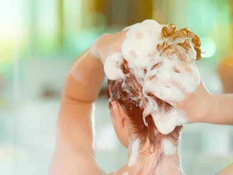 3 thói quen tưởng tốt nhưng lại khiến tóc yếu, gàu nhiều và dễ gãy rụng