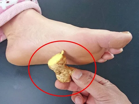 4 lợi ích tuyệt vời khi đắp gừng vào lòng bàn chân vào buổi tối