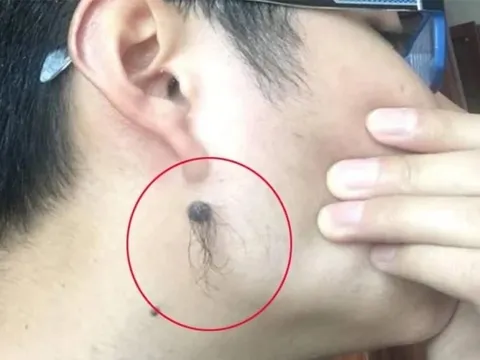 Mọc lông ở 4 vị trí này trên cơ thể càng nhiều thì càng phát tài, phú quý tìm đến, tài lộc đồi dào