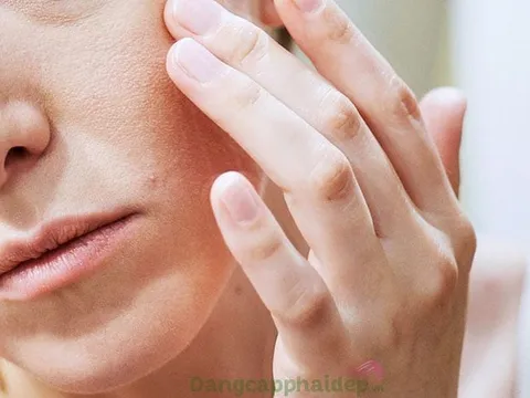 Mẹo để làn da không bị nếp nhăn mùa hanh khô