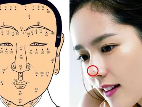 4 nốt ruồi chặn cửa Thần Tài: Ai có 1 cũng nên hóa giải