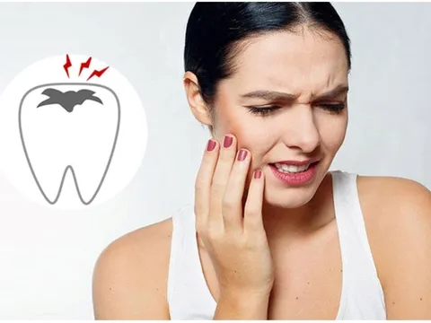 Có 4 thời điểm tuyệt đối không nên nhổ răng, kẻo rước họa vào thân