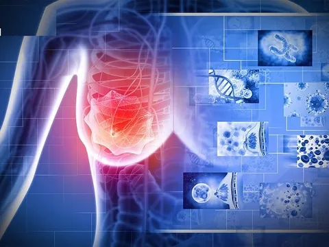 “3 đen” xuất hiện trên cơ thể báo hiệu bệnh K rất gần, gặp bác sĩ ngay