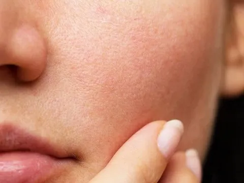 5 cách đơn giản tạm biệt khô da mùa hanh