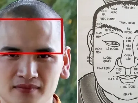 Người xưa nói, “Trán rộng như vàng, sau đầu đầy như bạc": Trán rộng thì sao?