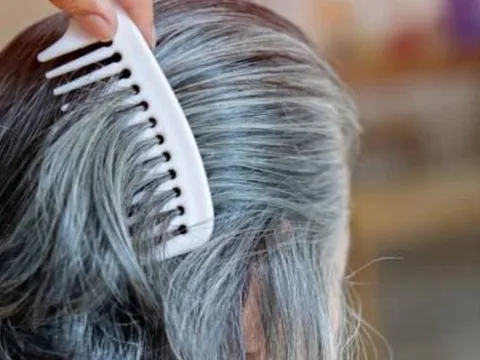 Tóc bạc có thể là dấu hiệu cơ thể đang tiêu diệt tế bào ung thư?