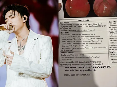 SOOBIN gửi kết quả khám cho fan: bị phù nề, sung huyết mũi họng hậu concert