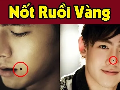 6 nốt ruồi may mắn hút tiền tài vào nhà