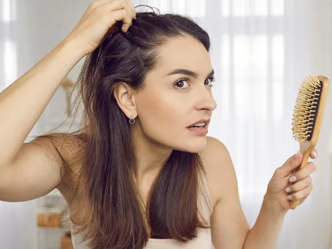 4 mẹo "giải cứu" tóc bết mùa đông