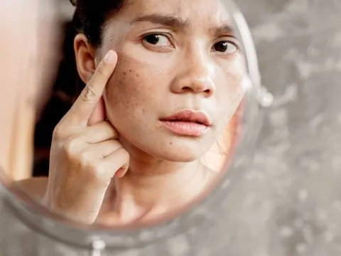 5 sản phẩm cần có bảo vệ da và tóc khỏi ô nhiễm không khí