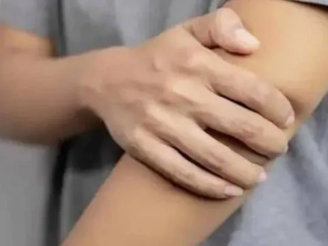 Cảnh báo ung thư: 4 dấu hiệu ở cánh tay tuyệt đối không được bỏ qua – Phát hiện sớm cứu sống bạn
