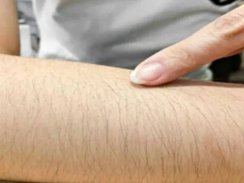 Nơi nào càng mọc nhiều lông càng có lợi cho sức khỏe? Tại sao nhiều người vẫn tẩy sạch, đặc biệt là phái nữ?