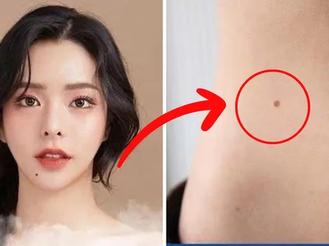 Phụ nữ có 3 nốt ruồi ở vị trí hiếm này: Số mệnh phú quý, viên mãn, tình tiền sáng rực rỡ