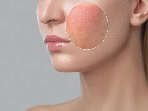 Cách xác định loại da của bản thân