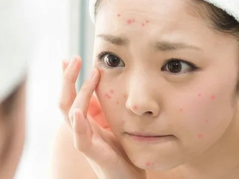 Ghim ngay lịch chăm da 7 ngày giúp da được nuôi dưỡng đúng nhu cầu và duy trì trạng thái khỏe mạnh lâu