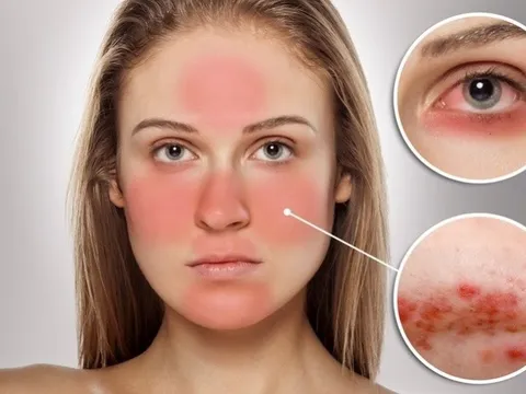 Những nguyên nhân phổ biến lý giải vì sao làn da ngày càng trở nên "khó chiều"