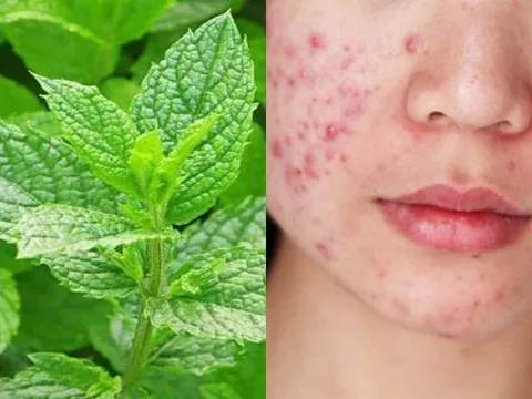 5 mẹo làm đẹp da và tóc với bạc hà