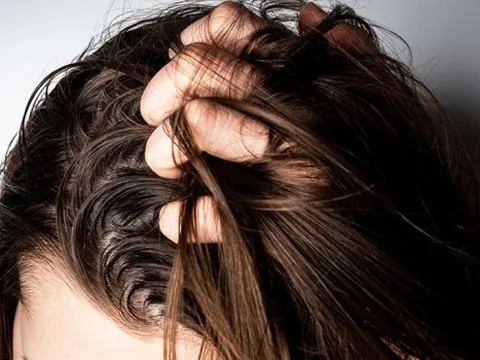 3 thói quen khiến nay gội mai tóc đã bết dầu