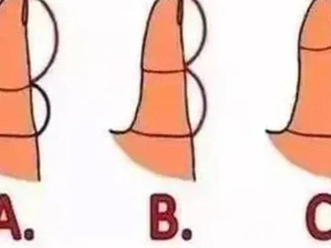 Quiz: Ngón tay cái tiết lộ tính cách và sức khỏe khi bạn về già, cực chính xác!