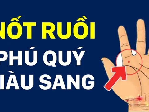 5 nốt ruồi trên tay Ăn May Cả Đời, có 1/5 cũng sướng