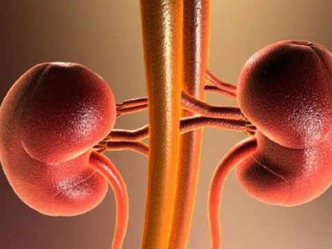 Suy thận không báo trước: 5 dấu hiệu sớm dễ nhầm với mệt mỏi thông thường