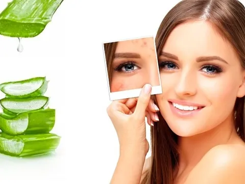 Công thức đơn giản của mặt nạ ngủ lô hội mật ong để có được làn da không tì vết