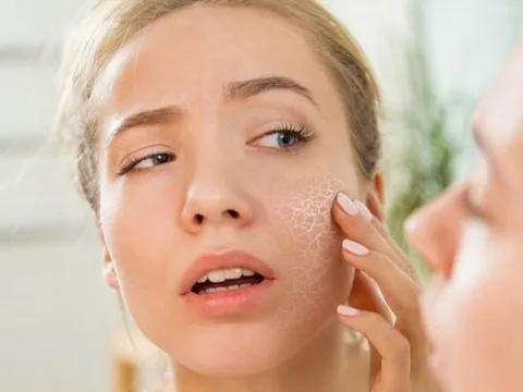 Muốn cải thiện làn da khô bong tróc, nàng cần chú ý bổ sung 3 thành phần cơ bản sau