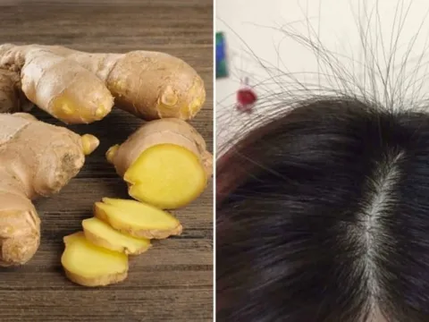 Cách gội đầu bằng gừng tươi trị gàu hiệu quả, da đầu sạch bong, tóc con mọc lên tua tủa