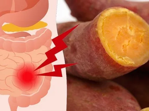 Khoai lang lành tính nhưng 4 người này không nên động đến