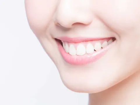 Tẩy trắng răng tại nhà: Cách cải thiện màu răng an toàn cho men răng nhạy cảm